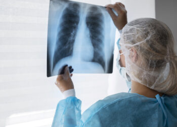 Profesionales de salud refuerzan llamado a prevenir y diagnosticar oportunamente el Cáncer de Pulmón