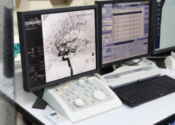 Especialistas llaman a prevenir accidentes cerebrovasculares 