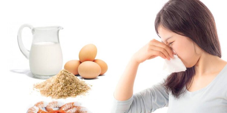 Sólo la mitad de las alergias e intolerancias alimentarias en Chile serían diagnosticadas por un profesional