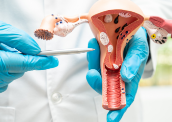 Detectar a tiempo el cáncer cervicouterino mejora el pronóstico y la efectividad de su tratamiento