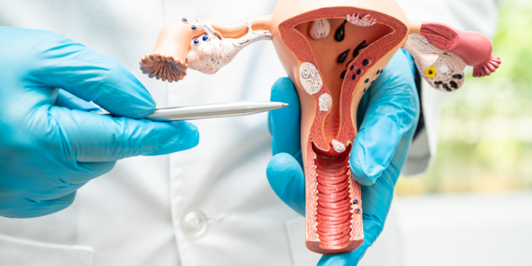 Detectar a tiempo el cáncer cervicouterino mejora el pronóstico y la efectividad de su tratamiento