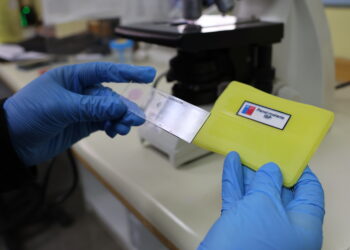 Laboratorio Clínico del Hospital de Chillán es uno de los 10 establecimientos nacionales que realizan estudio microscópico de malaria