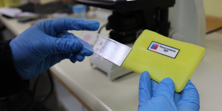 Laboratorio Clínico del Hospital de Chillán es uno de los 10 establecimientos nacionales que realizan estudio microscópico de malaria