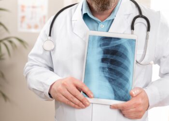 Día Mundial del Cáncer de Pulmón: Profesionales de salud refuerzan llamado a la prevención y diagnóstico oportuno